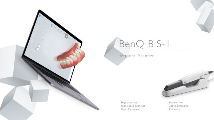 Scanner Intraorale